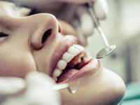 מרפאת שיניים בבת ים לשיקום מושלם של הפה